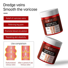 Load image into Gallery viewer, 80g Feet Varicose Veins Cream Treatment