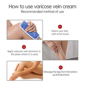 80g Feet Varicose Veins Cream Treatment