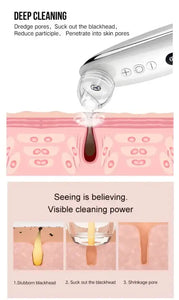 Electric Visual HD Camera WIFI Blackhead Removal Apparatus