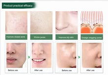Load image into Gallery viewer, Portable Digital Microdermabrasion Diamond Massage Skin Peeling Device