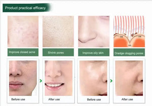 Portable Digital Microdermabrasion Diamond Massage Skin Peeling Device