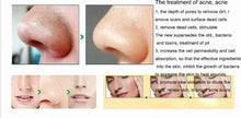 Load image into Gallery viewer, Portable Digital Microdermabrasion Diamond Massage Skin Peeling Device