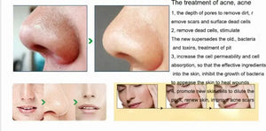 Portable Digital Microdermabrasion Diamond Massage Skin Peeling Device