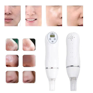 Portable Digital Microdermabrasion Diamond Massage Skin Peeling Device