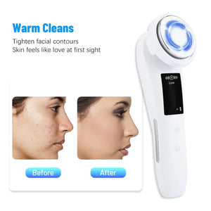 EMS Anti-Aging 7 in 1 Face Lift RF Skin Rejuvenation