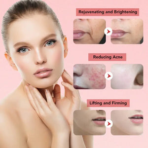 EMS Anti-Aging 7 in 1 Face Lift RF Skin Rejuvenation